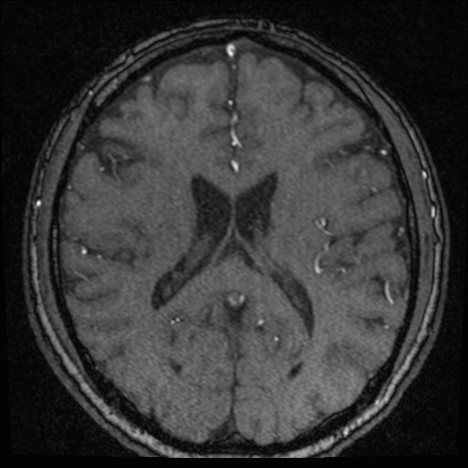 Click on the Serie image to view the images of VILLANUEVA, WILLIAM A.